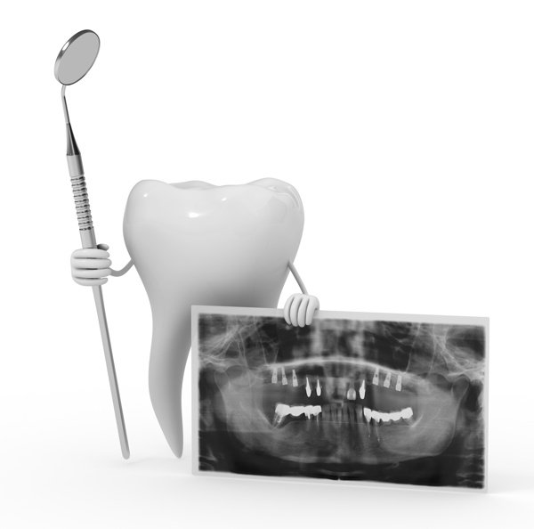 problema implante dental