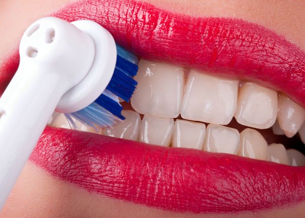 Higiene oral después de la colocación de implantes dentales