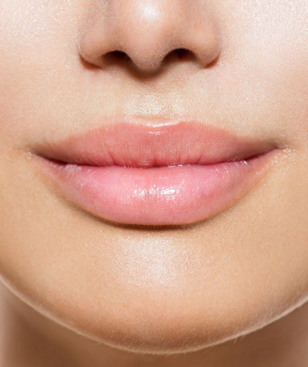 El ácido hialurónico y el aumento de labios: resultados naturales