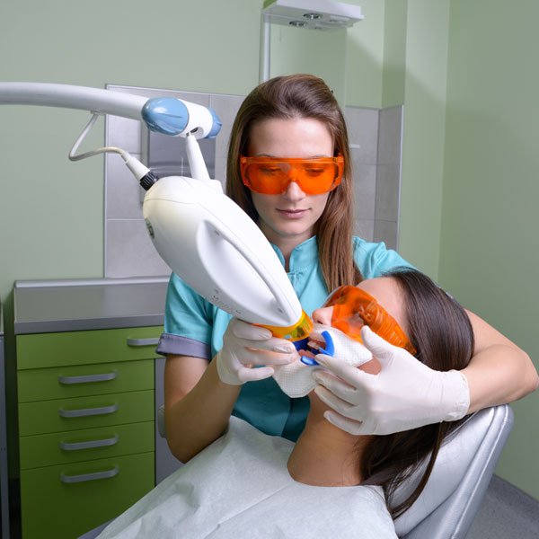 Blanqueamiento dental: ¿cuántas sesiones se necesitan?