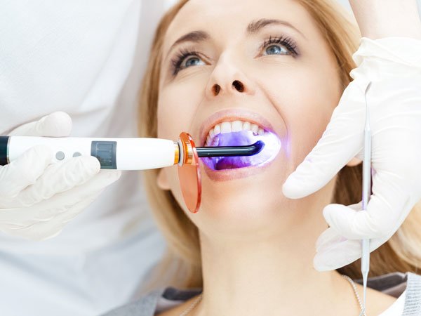 Tratamiento para eliminar las manchas dentales
