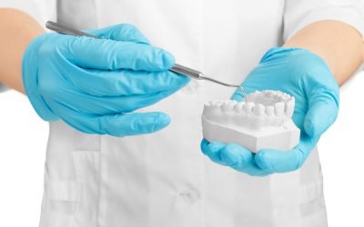 Todo lo que debes saber sobre las incrustaciones dentales