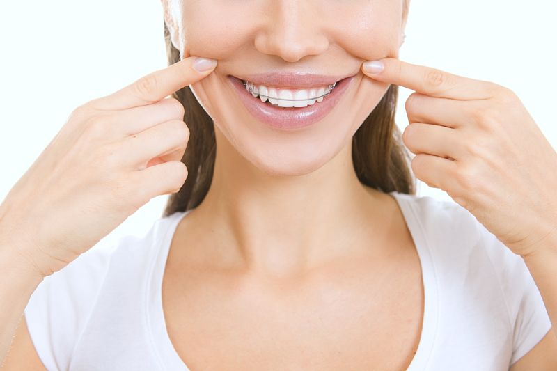 Consejos y cuidados de los retenedores dentales