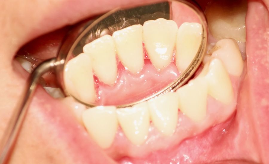 ortodoncia preventiva ninos dentista barcelona Axioma clínica dental en Barcelona