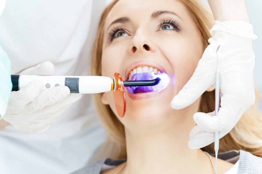 Riesgos del blanqueamiento dental sin control