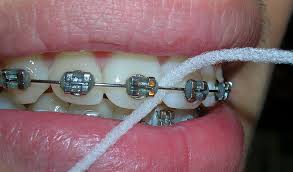 Mm Teoría establecida Chillido Hilo dental, antes o después del cepillado - Axioma Estudi Dental