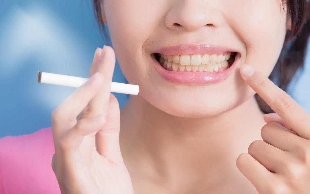 maíz Vaca granizo Cómo saber si padeces un cáncer oral? - Axioma Estudi Dental