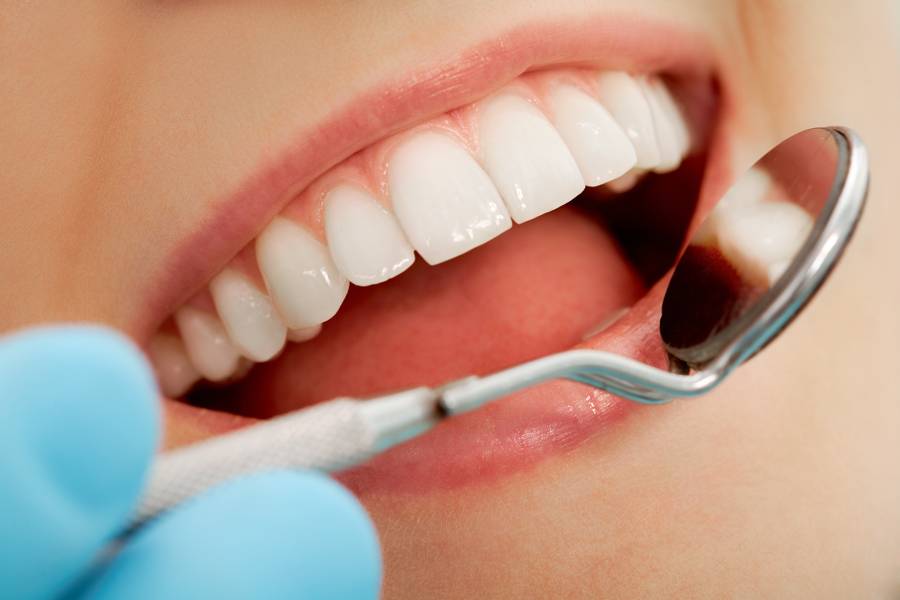 ¿Qué es la caries dental?