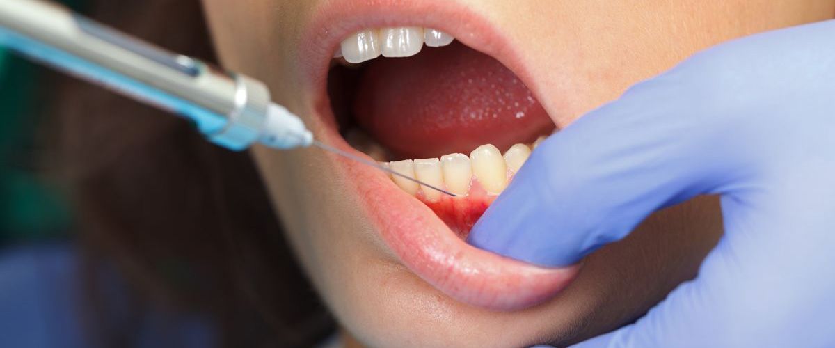capítulo temporal Ilegible Cuánto dura la anestesia dental? - Axioma Estudi Dental